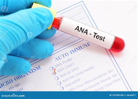 ANA test stock photo. Image of hospital, hematology - 101369166