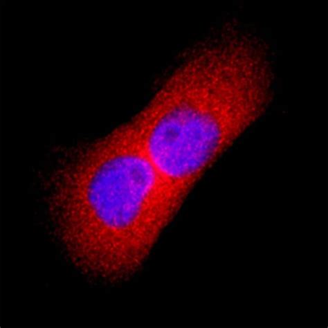 Human Thymidine Kinase 1 Antibody, R 100 μg; Unconjugated:Antibodies ...