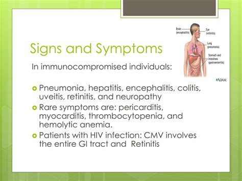 PPT - CYTOMEGALOVIRUS PowerPoint Presentation, free download - ID:3176476