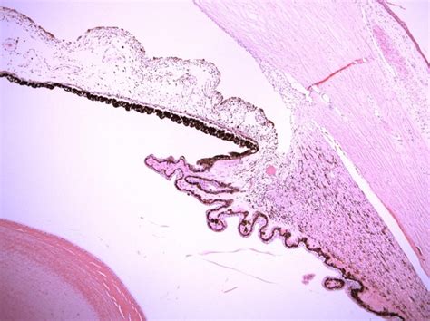 Anatomy of Ciliary Body, Ciliary Processes, Anterior Chamber Angle and Collector Vessels ...