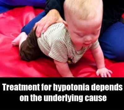 Hypotonia – Symptoms, Causes And Treatment – Natural Home Remedies ...