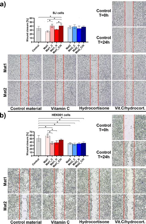 Cell migration after exposure to the extracts of biomaterials: (a ...