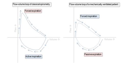 Interpreting the shape of the flow-volume loop | Deranged Physiology