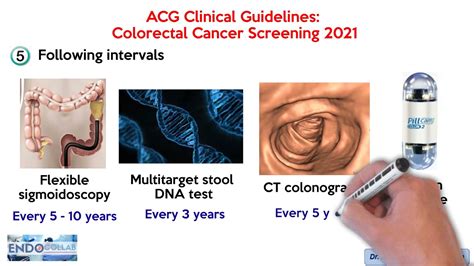 Colorectal Cancer Screening - ACG Clinical Guidelines: 2021 - YouTube