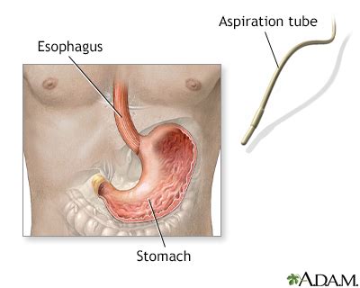 Stomach Acid Diagram