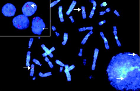 Fish Chromosomes