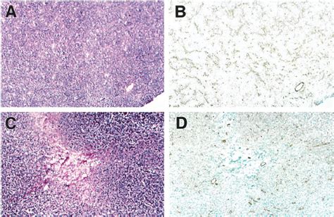 Tumor tissue histology. Histology of LLC tumors from C57BL/6 mice ( ϫ ...