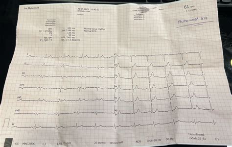 ekg results : r/EKG