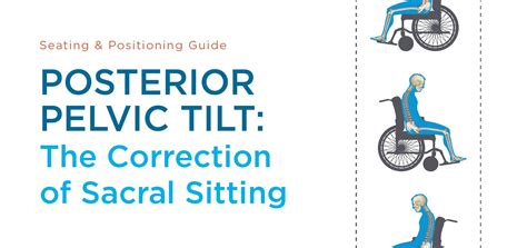 Posterior Pelvic Tilt: The Correction of Sacral Sitting