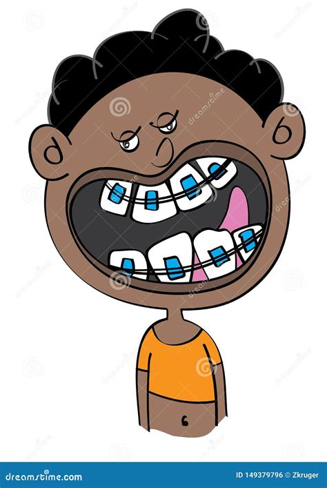 Funny Black Boy with Dental Braces Cartoon Stock Vector - Illustration ...