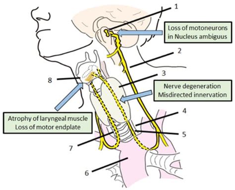 Genes | Free Full-Text | Gene Therapy for Recurrent Laryngeal Nerve Injury