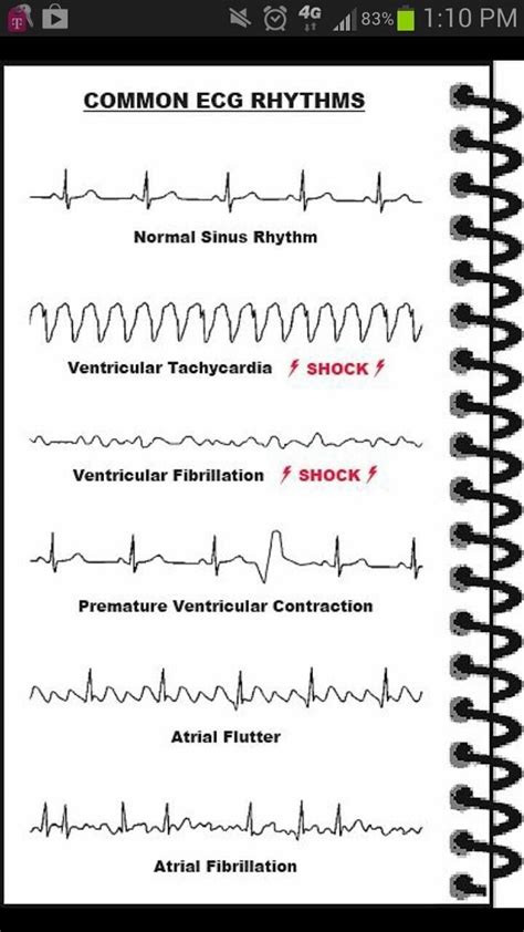 Pin by Ayka Sh-va on Medizin | Cardiac nursing, Nurse, Nursing school ...