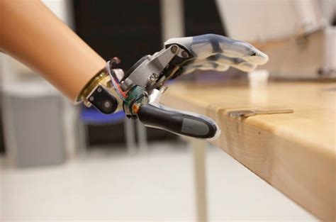 How Bionics are Redefining the Future of Prosthetics