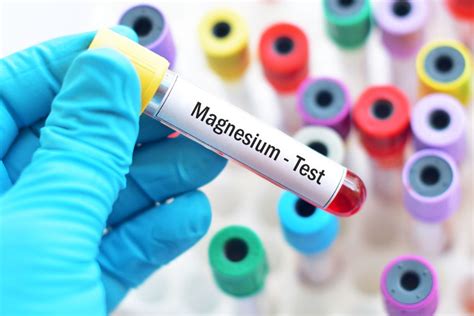 Magnesium Blood Test