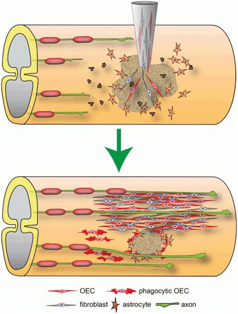 Transplantation of Olfactory Ensheathing Cells in Spinal Cord Injury ...