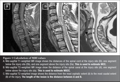 Figure 1 from Acute traumatic cervical spinal cord injuries ...