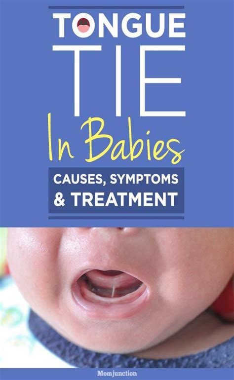 Tongue Tied Baby (Ankyloglossia): Causes, Symptoms & Treatment | Tongue tie, Tounge tied baby ...