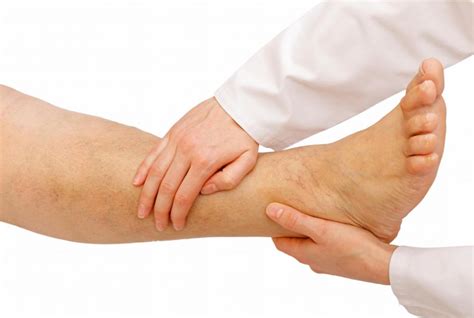 What Are the Symptoms of Ankle Gout? (with pictures)