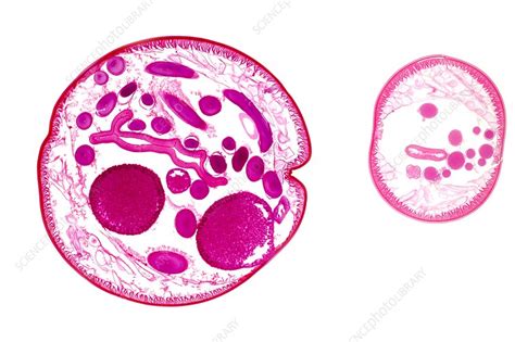 Ascaris roundworm, light micrograph - Stock Image - C011/6233 - Science Photo Library