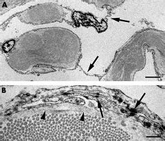 TEM morphology of arachnoid trabeculae in the bulbar segment. The... | Download Scientific Diagram