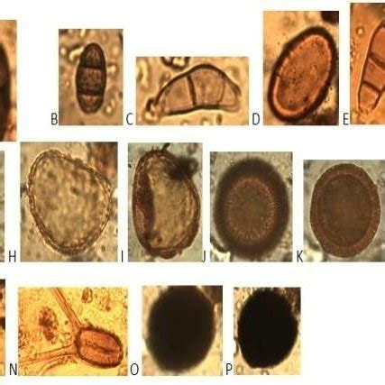 A-P: FUNGAL SPORES: Botryodiplodiatheombromae: A; Pithomyces: B ...