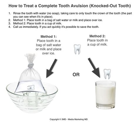 Tooth Trauma and Nerve Damage to Teeth - Southlake Endodontics