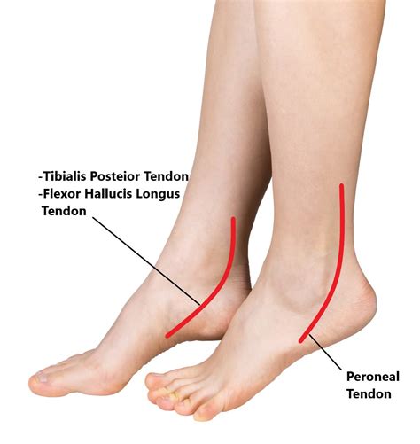 Common Ankle Injuries - My Family Physio