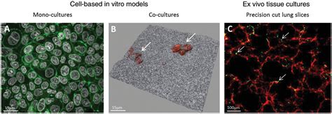 In vitro-ex vivo model systems for nanosafety assessment