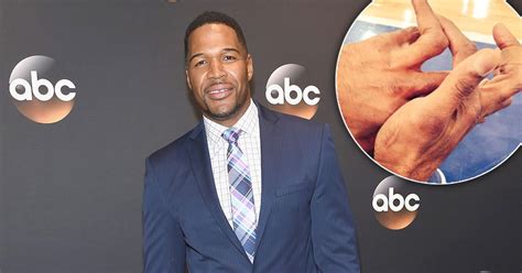 How Did Michael Strahan Lose Part Of His Pinky Finger?