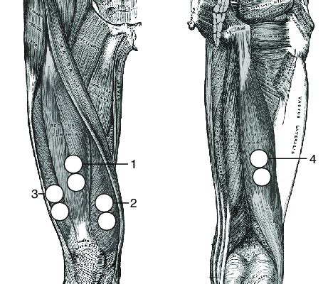 EMG sensor placement: 1) M. rectus femoris, 2) M. vastus medialis, 3 ...