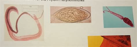 Schistosoma mansoni Life Cycle Diagram | Quizlet