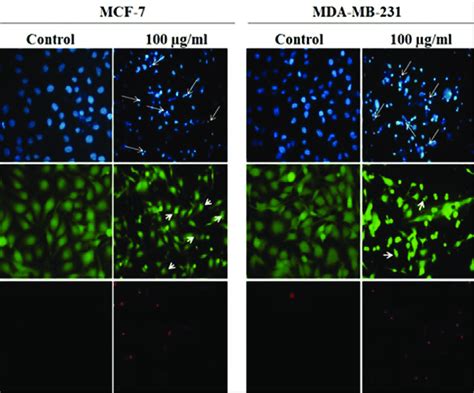 Fluorescence imaging for determination of cell death mode. The cells... | Download Scientific ...