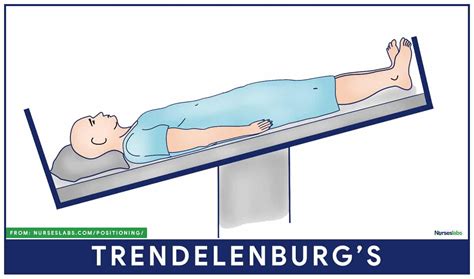 Why Would You Put A Patient In Reverse Trendelenburg Position? | ICU ...