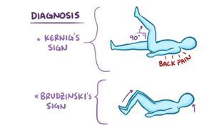 Clinical-Signs for Meningitis - MEDizzy