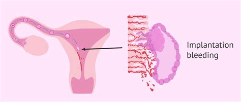 Embryonic development and implantation bleeding