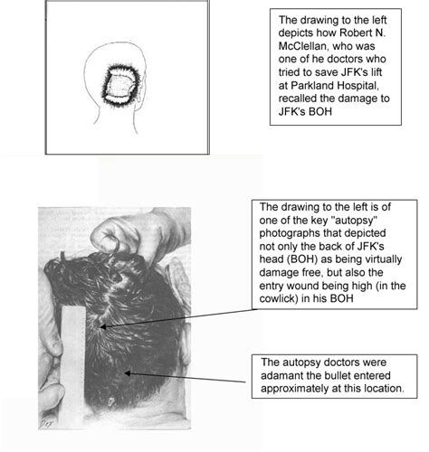 Historic Mix-Up by Top Forensic Experts Clouds JFK Case