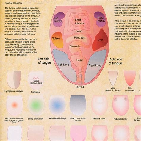 Ayurveda Tongue Diagnosis Poster Ayurveda Tongue Chart - Etsy