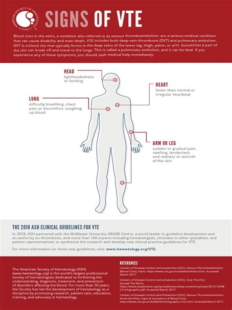 Signs of VTE Infographic PDF | PDF | Vein | Thrombosis