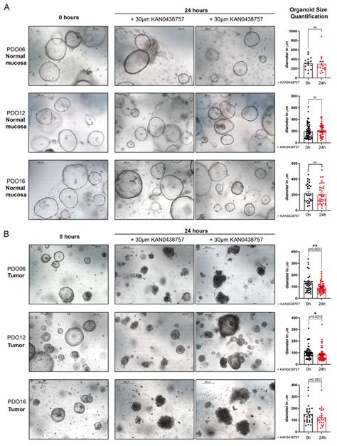 KAN0438757 effects on intestinal patient-derived organoids. (A,B ...