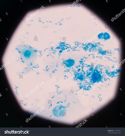 Blue Bacteria Gram Stain Sputum Stock Photo 417970639 | Shutterstock