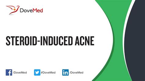 Steroid-Induced Acne