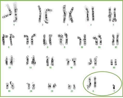 Xxyy Chromosome