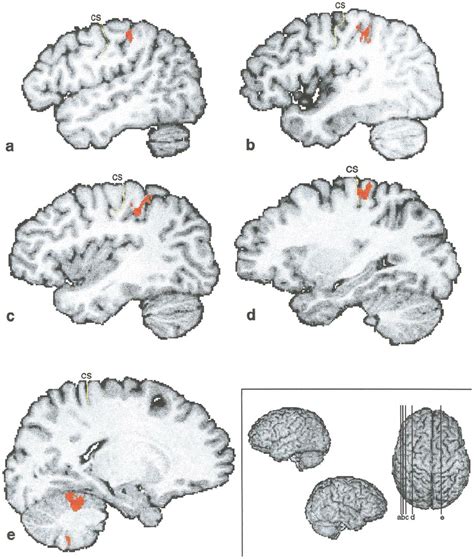 Illustration of the tactile representation of the stimuli. Shown are ...