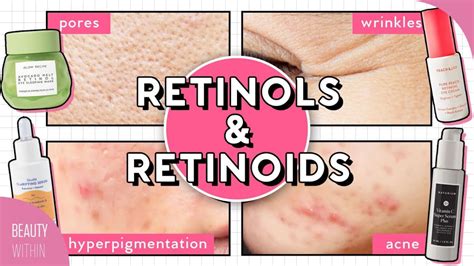 How to Use Retinol for Acne, Hyperpigmentation, Large Pores, Fine Lines, & More!