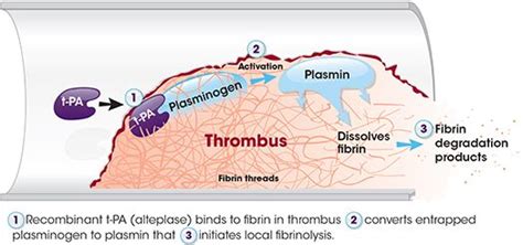 Alteplase Mechanism of Action