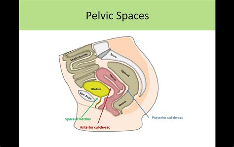 Space Of Retzius Ultrasound