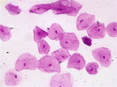 cheek cells 400x stained | Flickr - Photo Sharing!