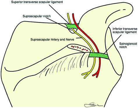 Suprascapular Ligament