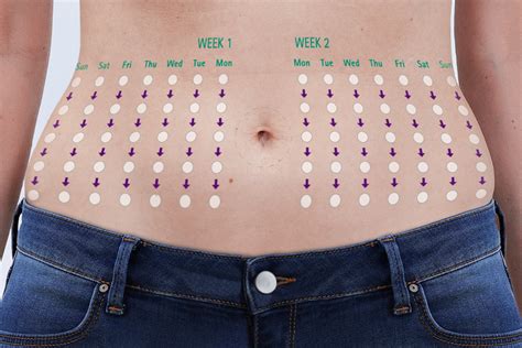 Picture Insulin Injection Sites - Insulin Injection Sites Stock Illustrations 8 Insulin ...