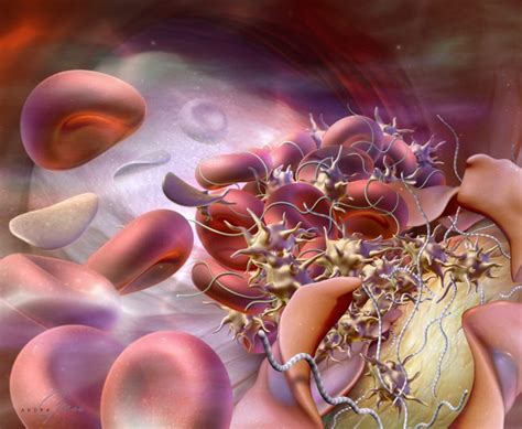 Thrombus Formation - Geras Healthcare Productions